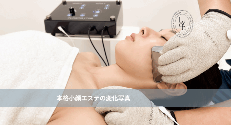 大名・赤坂・天神のリフトアップ専門サロンLyonの小顔矯正フェイシャル