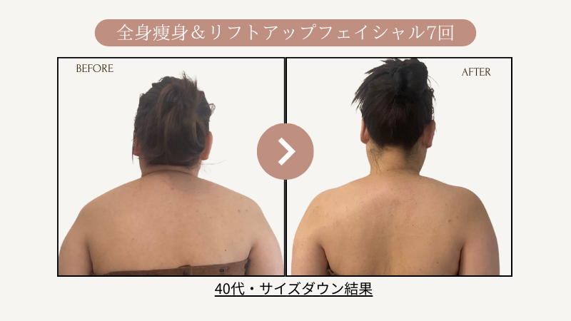 リフトアップフェイシャル、全身痩身7回サイズダウン結果写真09、ビフォーアフター写真｜リフトアップ専門店リヨン「大名/赤坂/天神07 