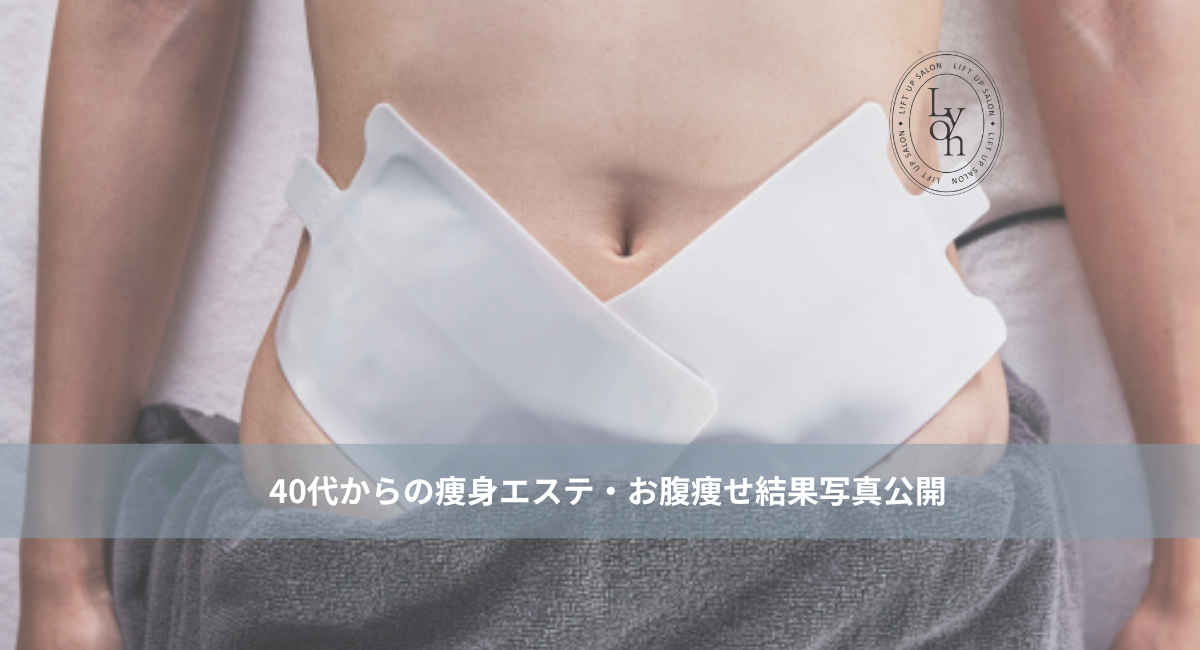 40代からの痩身エステ◎たった15分でお腹痩せ｜大名・天神・赤坂リヨン