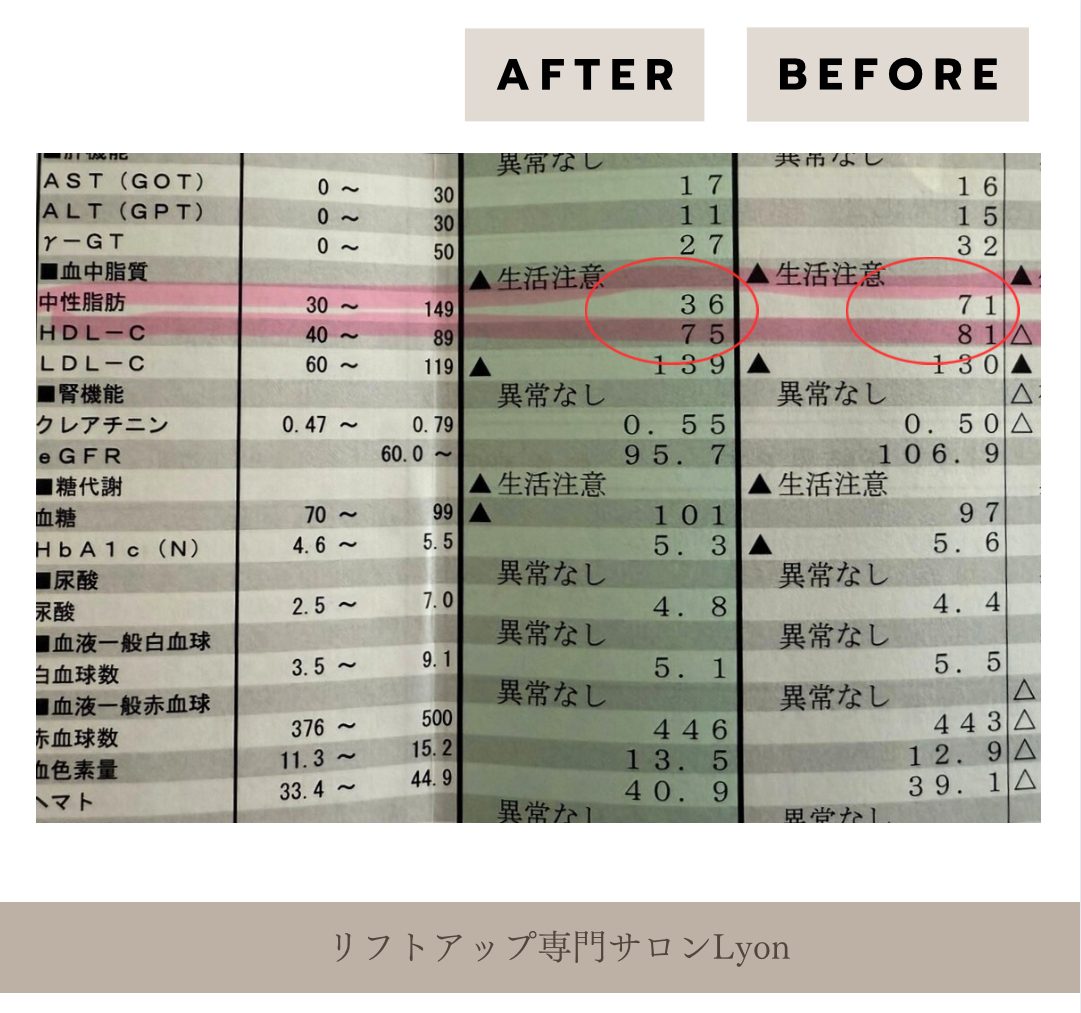 リフトアップフェイシャル、全身痩身2ヵ月中性脂肪ダウン、健康診断結果写真｜リフトアップ専門店リヨン「大名/赤坂/天神リヨン」