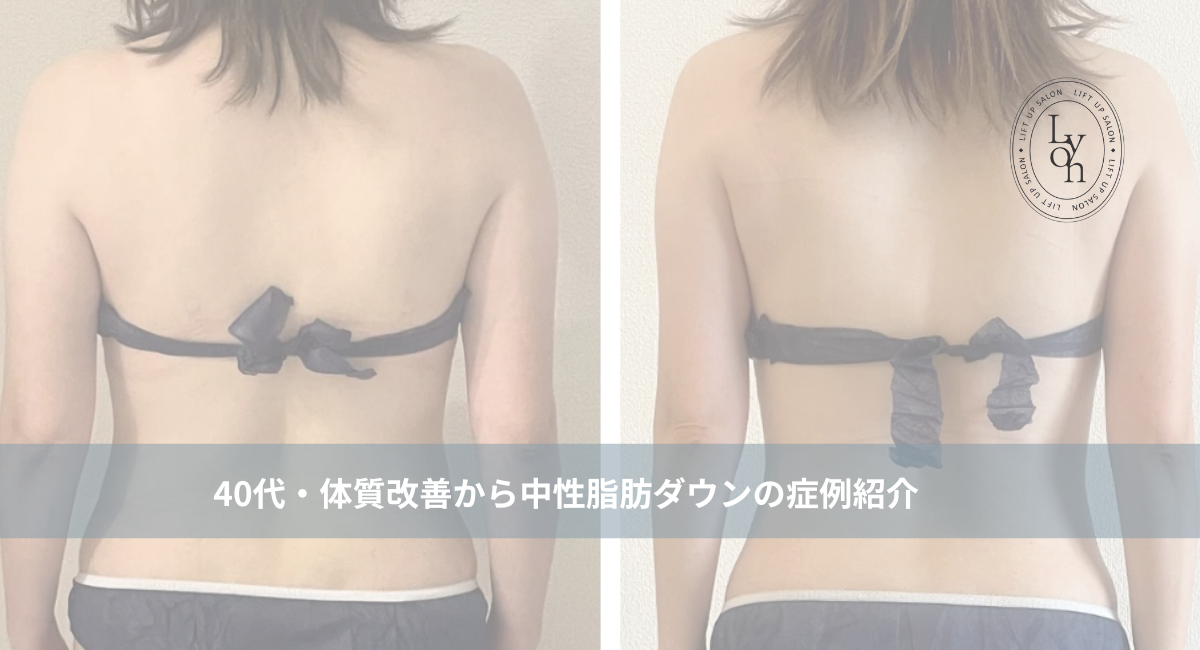 シェイプリフト　定価約30万　美容　痩身　ダイエット 先日32歳になりましたー！ ダイエットも筋トレも始めて本当に