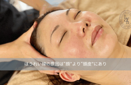 大名・赤坂のリフトアップ専門サロンLyonのブログ/ほうれい線の原因/アイキャッチ画像