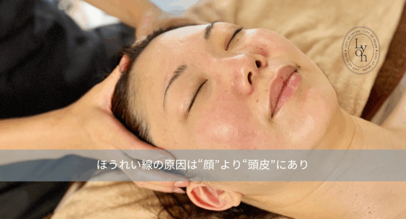 大名・赤坂のリフトアップ専門サロンLyonのブログ/ほうれい線の原因/アイキャッチ画像