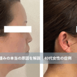 大名・赤坂のリフトアップ専門サロンLyonのブログ/浮腫みの原因/アイキャッチ画像