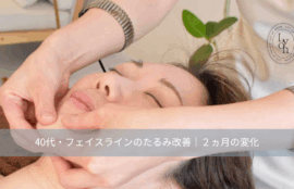 大名・赤坂のリフトアップ専門サロンLyonのブログ/フェイスライン・たるみ・改善|大名・赤坂・天神Lyon/アイキャッチ画像