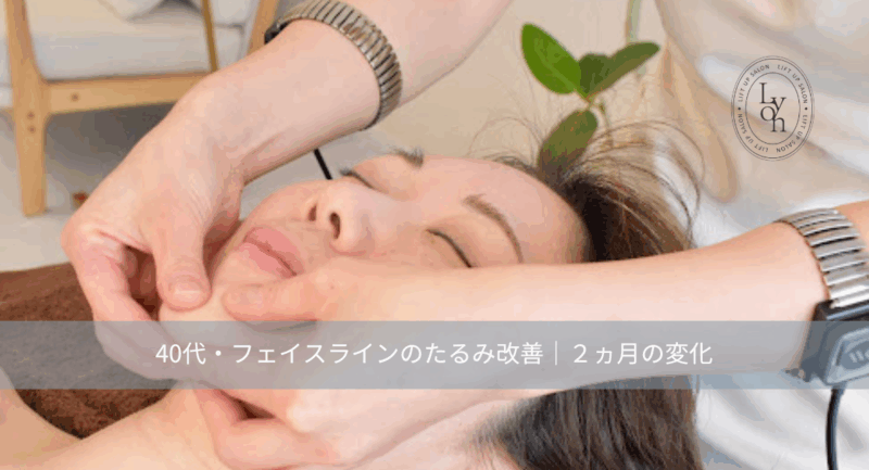大名・赤坂のリフトアップ専門サロンLyonのブログ/フェイスライン・たるみ・改善|大名・赤坂・天神Lyon/アイキャッチ画像