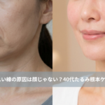 大名・赤坂のリフトアップ専門サロンLyonのブログ ｜ほうれい線の原因は顔じゃない？40代たるみ根本ケア大名・天神Lyon/アイキャッチ画像