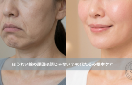 大名・赤坂のリフトアップ専門サロンLyonのブログ ｜ほうれい線の原因は顔じゃない？40代たるみ根本ケア大名・天神Lyon/アイキャッチ画像