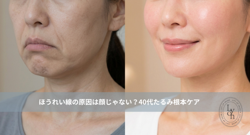 大名・赤坂のリフトアップ専門サロンLyonのブログ ｜ほうれい線の原因は顔じゃない？40代たるみ根本ケア大名・天神Lyon/アイキャッチ画像