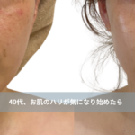 大名・赤坂のリフトアップ専門サロンLyonのブログ /【40代、肌のハリが気になり始めたら】内側からふっくら弾むツヤ肌を作るエステ｜大名・天神エステ/アイキャッチ画像